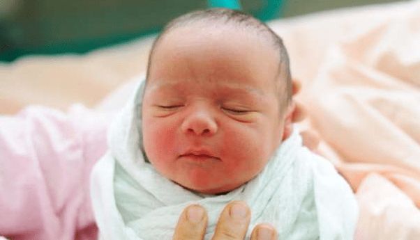 Mengenal Positional Plagiocephaly, Penyebab Umum Kepala Bayi Peyang