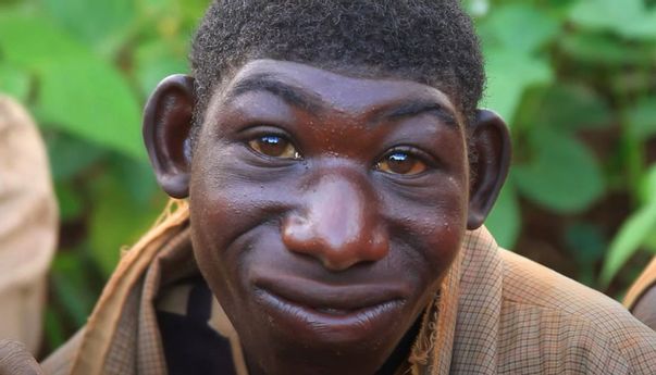 Zanziman Ellie Pilih Tinggal di Hutan karena Kerap Dibuli Warga dan Disebut Mirip Mowgli