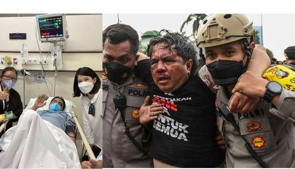 Usai Dikeroyok Sampai Babak Belur, Ade Armando: Jangan Pikir Saya Takut, Justru Akan Semakin Gila