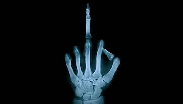 Cegah Osteoporosis! Ilmuwan di Arizona Temukan Microchip yang Bisa Ditanam ke Tulang