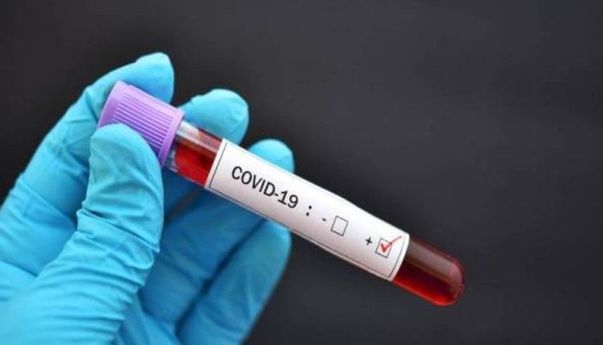 Ada Kemungkinan Munculnya Varian Baru Covid-19 yang Lebih Mematikan Lagi, Begini Kata Ilmuwan