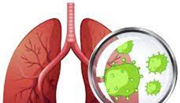 Cara Mudah Membersihkan Paru-paru dari Dahak yang Berlebih