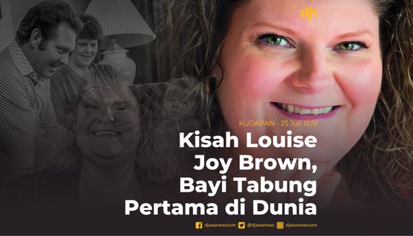 Kisah Louise Joy Brown, Bayi Tabung Pertama di Dunia