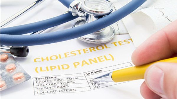 Ketahui Alasan Kenapa Kolesterol Tubuh Perlu Dikontrol