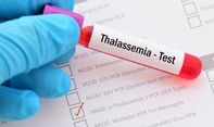 Penularan Thalasemia Secara Genetis Belum dapat Dicegah, Ini Saran Dokter