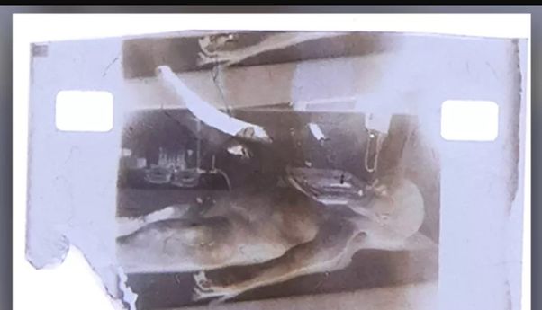 Video Rekaman Autopsi Alien Tahun 1947 Dilelang Rp14 Miliar