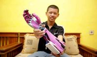 Anak SMK di Tasikmalaya Berhasil Ciptakan Tangan Robot Khusus Disabilitas