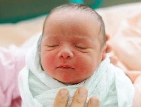 Mengenal Positional Plagiocephaly, Penyebab Umum Kepala Bayi Peyang