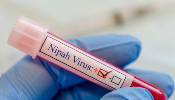 Apakah Kemunculan Virus Nipah Sebagai Pendatang Baru akan Gantikan Pandemi Setelah Covid-19?