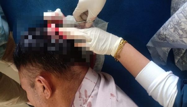 Kena Bacok: Dua Polisi Diserang Orang Gangguan Jiwa di Aceh