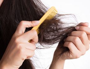 Ladies, Inilah Cara Mudah Mengatasi Rambut Kering dan Mengembang