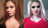 Jangan Lakukan Ini Jika Tak Ingin Punya Bibir Seperti Milik Andrea Emilova Ivanova