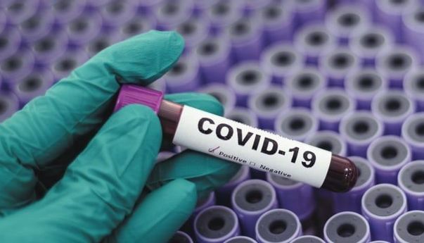Pelayanan Dibatasi Pasca Puluhan Nakes RSUD Blora Terjangkit Covid-19