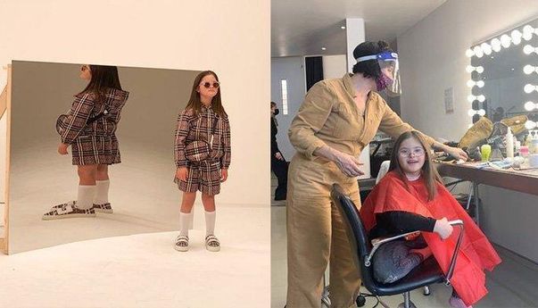 Belajar dari Roni Littman, Penderita Down Syndrome yang Berhasil Jadi Super Model Burberry